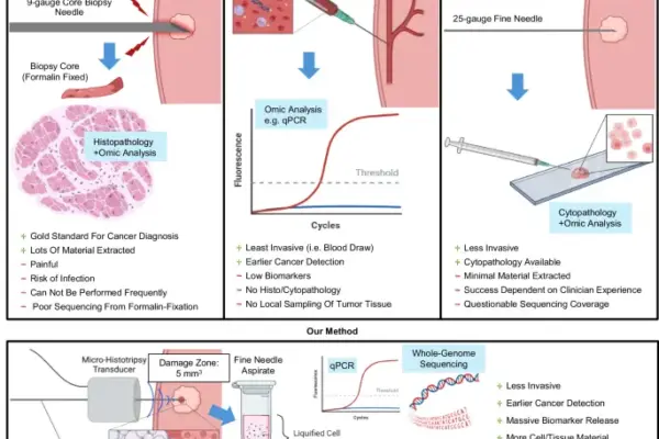 Breaking Barriers in Oncology: The Rise of Shock-Scattering Micro-Histotripsy-Aided Fine Needle Aspiration
