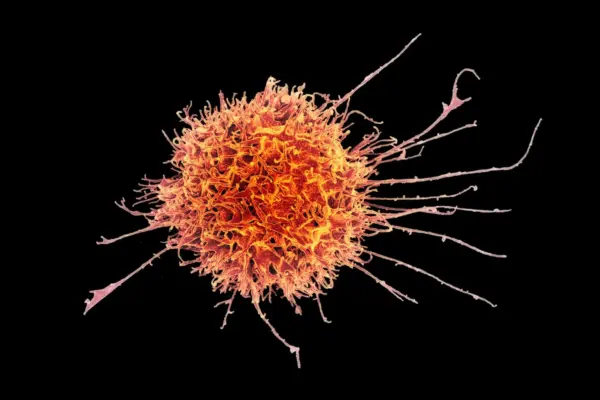 Breakthrough at Stanford: Engineered Natural Killer Cells Open the Door to Effective Solid Tumor Immunotherapy