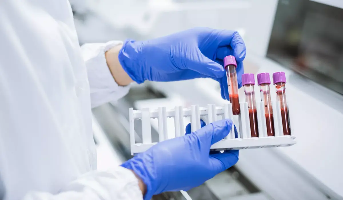 Bridging Innovation and Equity: The Evolving Landscape of CAR T-Cell Therapy Access in Brazil