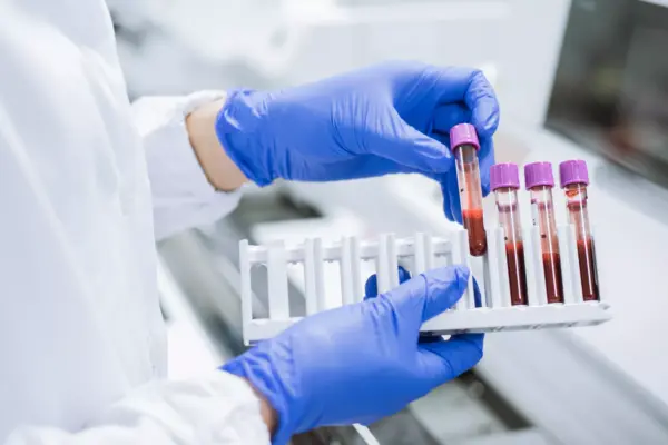 Executive Overview: The Hidden Toll of Leukaemia Caregiving