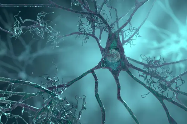 Executive Overview: Unlocking the Early Mechanisms of Alzheimer’s Risk