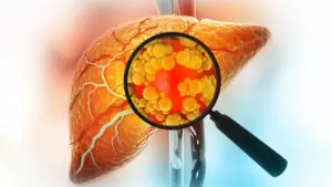 Groundbreaking Michigan Medicine Study Reveals Experimental Drug DT-109 Reverses Severe Fatty Liver Disease by Targeting the Gut-Liver Axis
