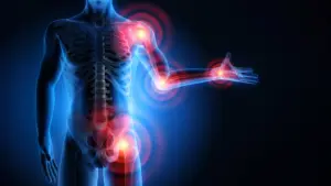 Unlocking the Biology of Statin Intolerance: McMaster Researchers Discover the Immune-Metabolic Link Behind Muscle Pain