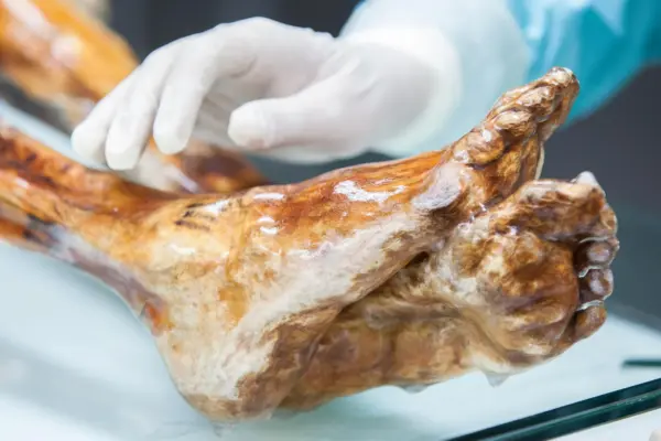 Unlocking the Iceman’s Microbiome: How Ötzi the Mummy Continues to Rewrite Microbiology, History, and Industrial Science